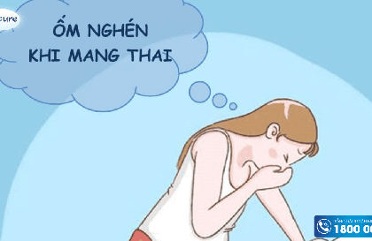 1001 các kiểu nghén khi mang thai 